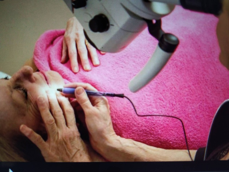 Spécialiste de l'épilation microtrolyse définitive du visage à Toulouse