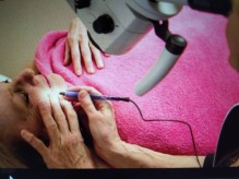 Spécialiste de l'épilation microtrolyse définitive du visage à Toulouse